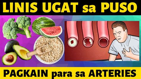 pagkaing bawal sa may sakit sa puso|️ 12 PAGKAIN na LUMILINIS ng UGAT sa PUSO o .
